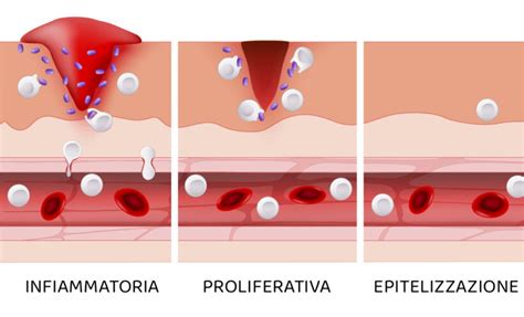  Kefiran: Protesi Ostearticolari Avanzate e Riparazione Tessutale Rigenerativa!