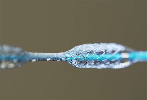 Nitinol: Una Lega Deformante per Impianti Medici Innovativi!