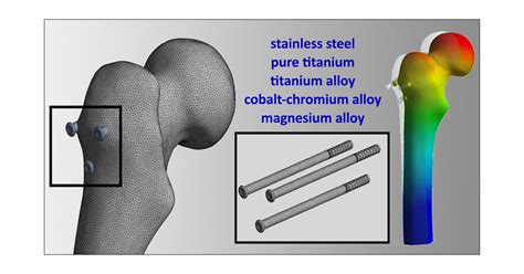 Osseointegratable Metal Alloys: Unlocking Biocompatibility for Advanced Orthopedic Implants!