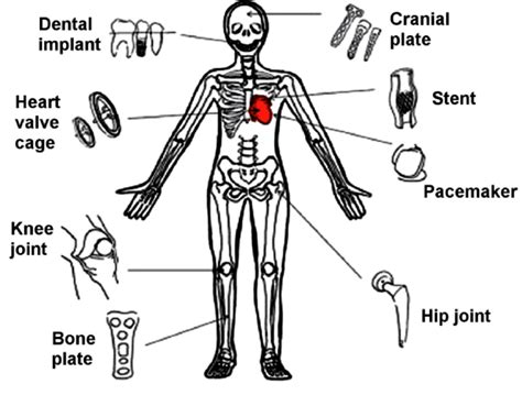  Titanio: Un metallo leggero per applicazioni aerospaziali e biomediche incredibili!