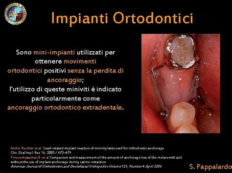  Wolframio: Caratteristiche Meccaniche di Eccellenza per Impianti Ortodontici Innovativi!